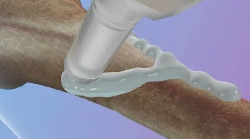 knochenkleber knochenbrueche heilen